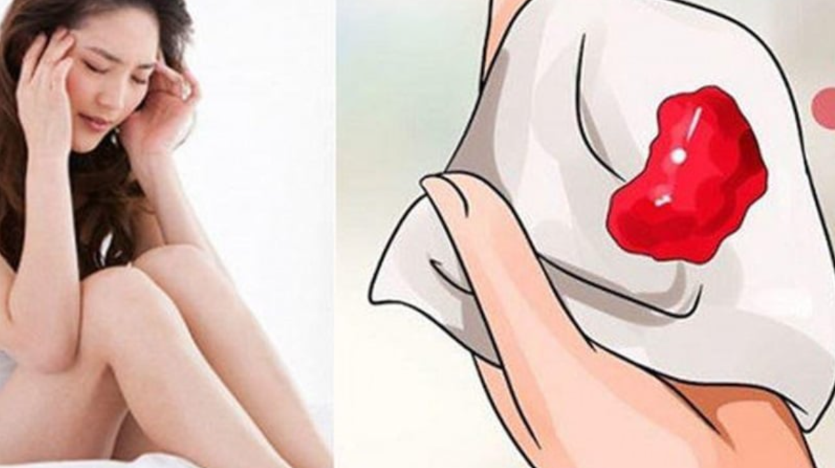 Cục máu đông là hiện tượng thường gặp trong kỳ kinh nguyệt.