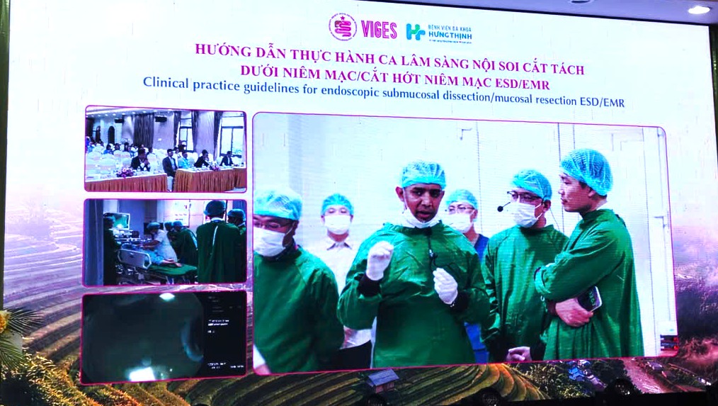 Cải Tiến Nội Soi Tiêu Hóa- Ảnh 2.