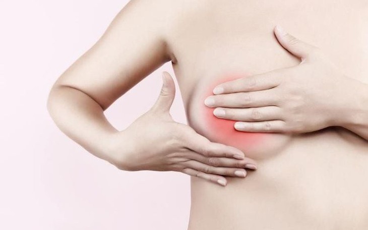 4 dấu hiệu bất thường cảnh báo ung thư vú - Ảnh 2.