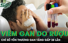 Câu Chuyện Rợn Người Về Một Người Đàn Ông Chứa Sán Dây Trong Cơ Thể Suốt 12 Năm
