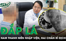 Khám Phá Ba Loại Cá Giá Rẻ Tốt Cho Sức Khỏe Của Bạn