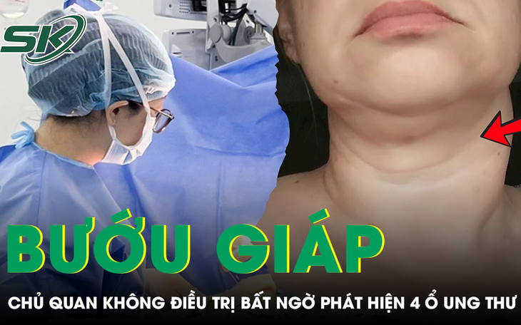 Bướu giáp không được điều trị dẫn đến biến chứng nghiêm trọng.
