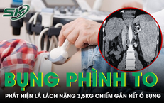 Nguyên Nhân Khiến Giới Trẻ Phải Đối Mặt Với Gan Nhiễm Mỡ