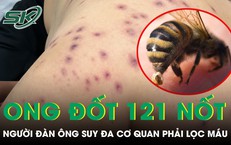 Cha Gặp Khó Khăn Với Vấn Đề Tiểu Tiện: Lời Kêu Gọi Tìm Kiếm Giải Pháp