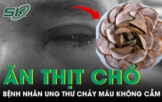 Khám Phá Lợi Ích Từ Trà Hoa Cúc Đối Với Sức Khỏe Gan