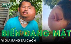 Khối U Lạ Khiến Nam Giới Mù Mắt: Nguyên Nhân và Giải Pháp