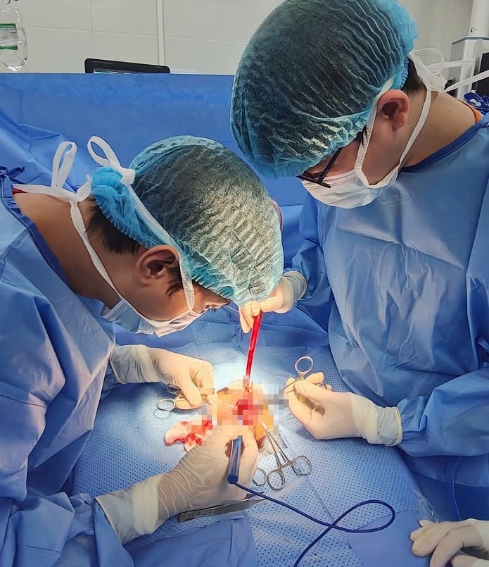 Chấn Thương Vùng Bìu: Những Điều Cần Biết Để Bảo Vệ Sức Khỏe