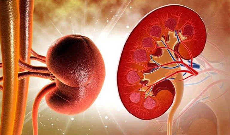 Viêm cầu thận - Lời khuyên dinh dưỡng.