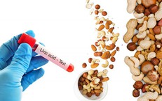 Mối Liên Hệ Giữa Đau Nửa Đầu và Chu Kỳ Kinh Nguyệt: Những Điều Bạn Cần Biết