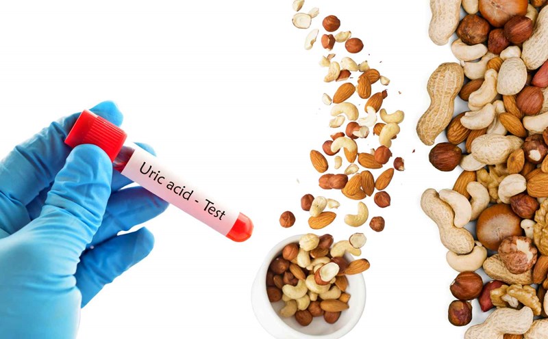Những Thói Quen Ảnh Hưởng Đến Mức Acid Uric Trong Cơ Thể