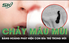 Nguy Cơ Mất Thị Lực Từ Một Tai Nạn Không Ngờ Tới