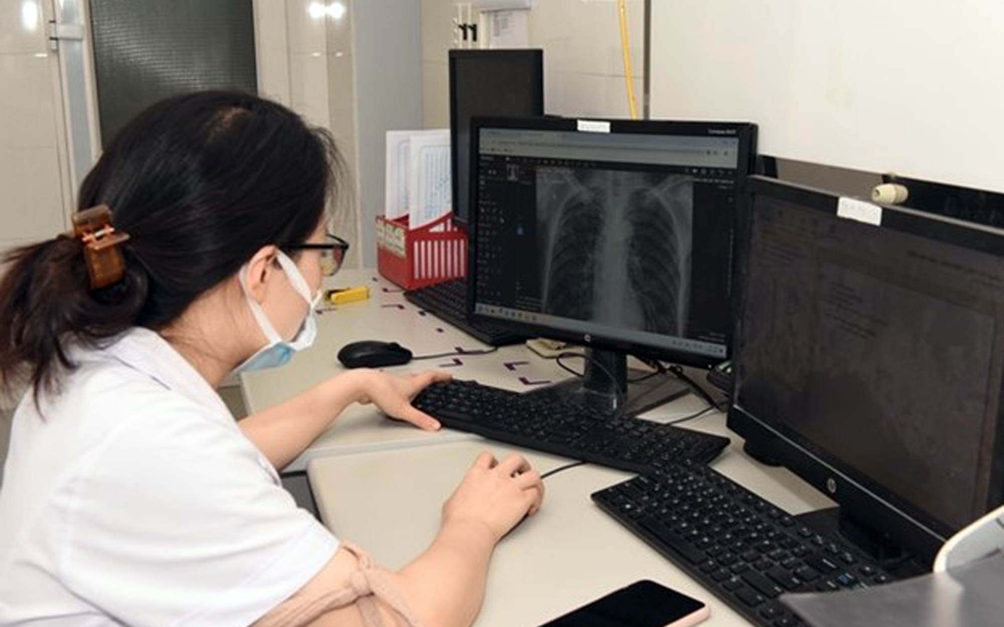 Thúc Đẩy Phê Duyệt Giá Dịch Vụ Chẩn Đoán Hình Ảnh Thông Qua PACS