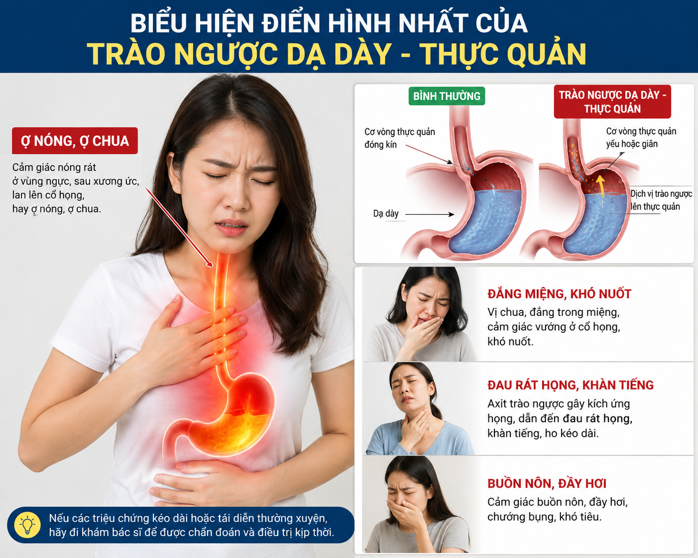 Bệnh trào ngược dạ dày - Thực quản có thể nhận biết sớm và chủ động phòng ngừa - Ảnh 2.