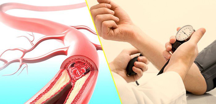 Có phải cứ chóng mặt là do cao huyết áp?- Ảnh 1.