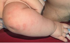 Giải Pháp Mới Trong Lưu Trữ Tế Bào Gốc Từ Máu và Mô Dây Rốn