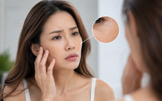 Chọn Tập Luyện Thế Nào Để Kiểm Soát Acid Uric Sau Tuổi 50?