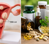 Thực Phẩm Bổ Sung Nào Không Nên Kết Hợp Với Canxi Để Bảo Vệ Sức Khỏe?