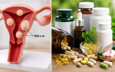 Thực Phẩm Bổ Sung Nào Không Nên Kết Hợp Với Canxi Để Bảo Vệ Sức Khỏe?