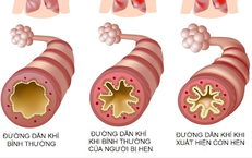 Những Dấu Hiệu Cần Lưu Ý Khi Trẻ Sặc Nước: Hướng Dẫn Cấp Cứu Tức Thì