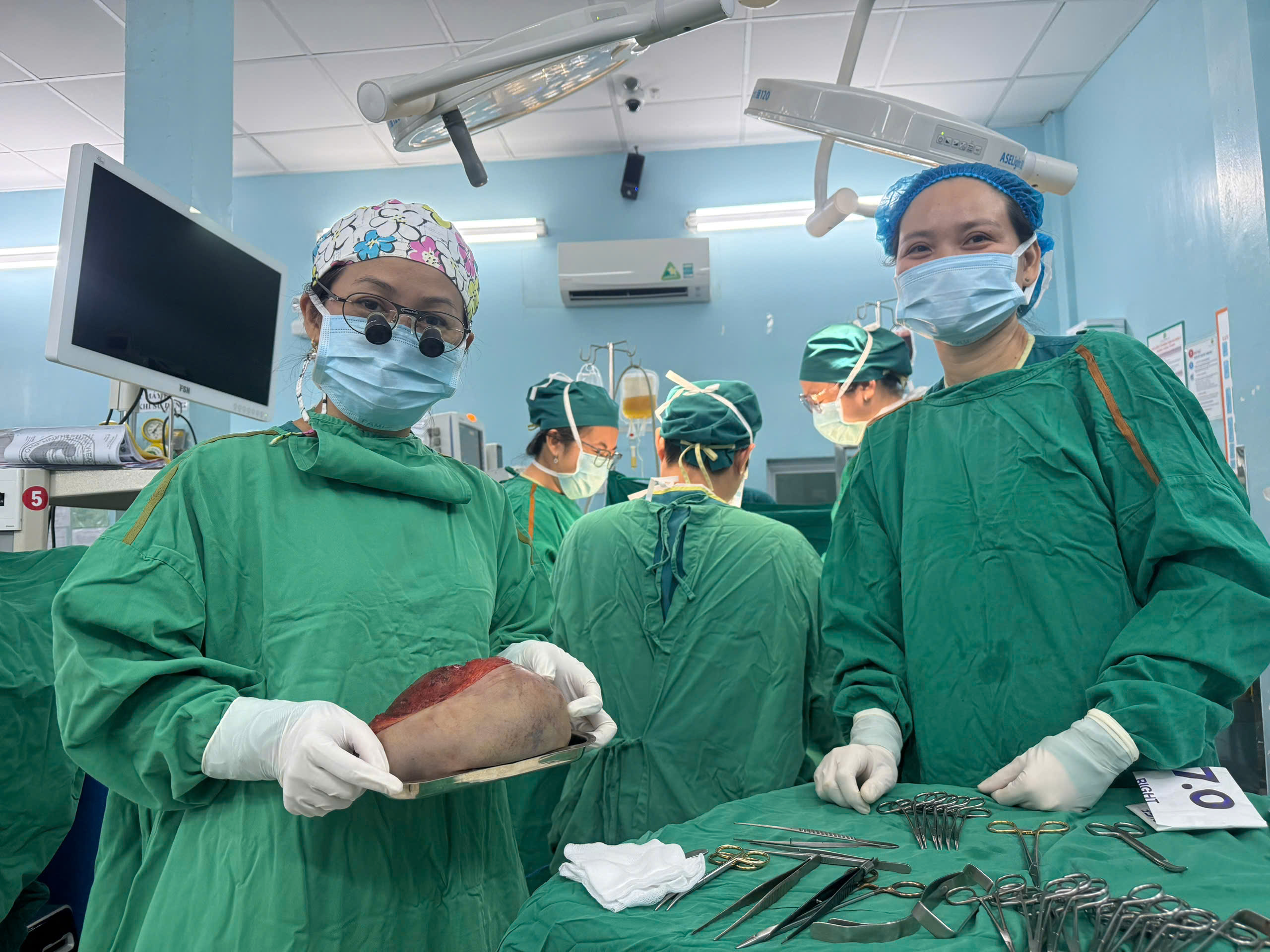 Lấy trọn khối u quái nặng 1,3 kg cho bé gái 5 ngày tuổi- Ảnh 1.