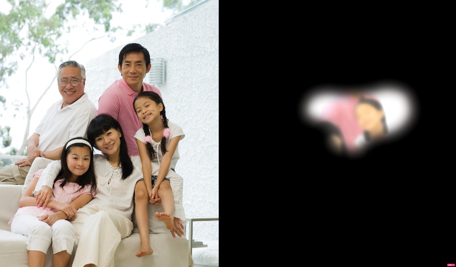 Những Khuyến Nghị Từ Chuyên Gia về Nguy Cơ Glaucoma và Cách Bảo Vệ Thị Lực