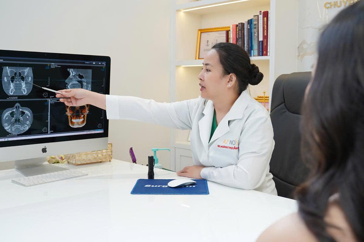 4 trường hợp thường được bác sĩ chỉ định nâng mũi cấu trúc- Ảnh 1.
