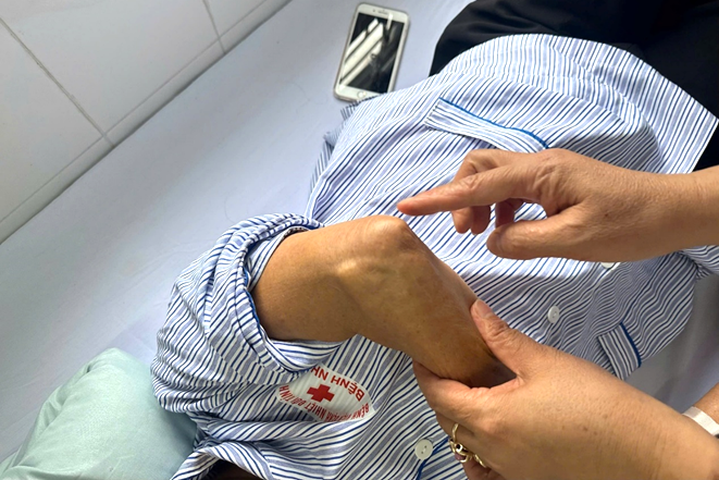 Khám Phá Nguyên Nhân Đau Khuỷu Tay: Một Trường Hợp Đáng Nhớ
