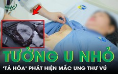 Câu Chuyện Cảnh Giác Khi Thực Hiện Bài Tập Squat Quá Mức