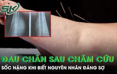 Khám Phá Lợi Ích Tuyệt Vời Của Khoai Lang Đối Với Bệnh Tiểu Đường