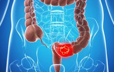 Giải Quyết Vấn Đề Bí Tiểu Ở Người Cao Tuổi: Nguyên Nhân Và Cách Chữa Trị