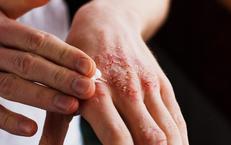 Tìm Hiểu Tràn Khí Màng Phổi Ở Trẻ: Nguyên Nhân Và Điều Trị