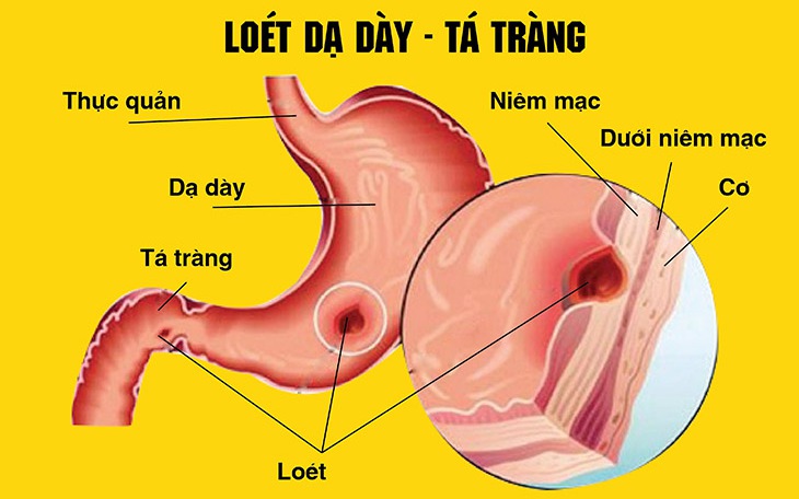 Cây xấu hổ có tác dụng chữa những bệnh gì? - Ảnh 3.