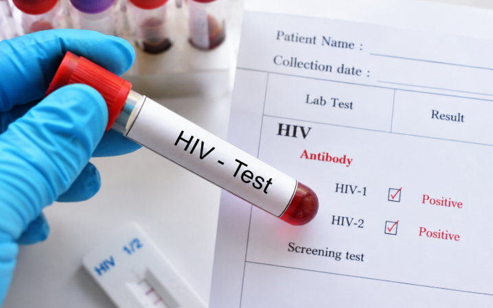 HIV và Thách Thức Các Bệnh Mạn Tính: Hiểu Rõ Để Phòng Ngừa