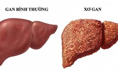 Tác Động Tiêu Cực Của Ca Đêm Đến Sức Khỏe Và Cách Khắc Phục
