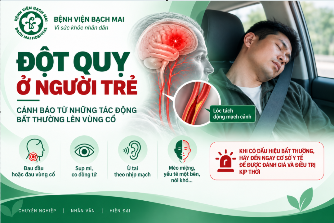 Lóc tách động mạch cảnh: hiểm họa đột quỵ từ tư thế cổ kéo dài ở người trẻ