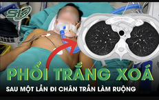 Cảnh Báo Sức Khỏe Từ Thói Quen Ăn Trái Cây Hàng Ngày