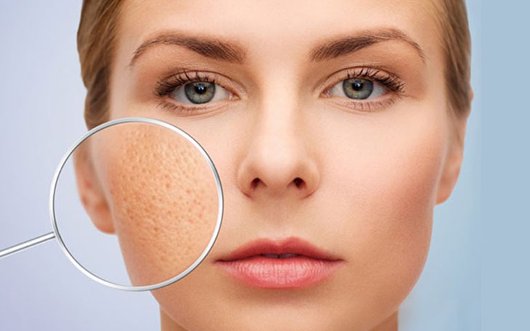 5 thực phẩm khiến phụ nữ lão hóa nhanh và mất cân bằng nội tiết - Ảnh 2.