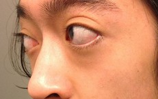 Lưu Ý Quan Trọng Khi Sử Dụng Thuốc Cường Dương Cho Người Bệnh Tim